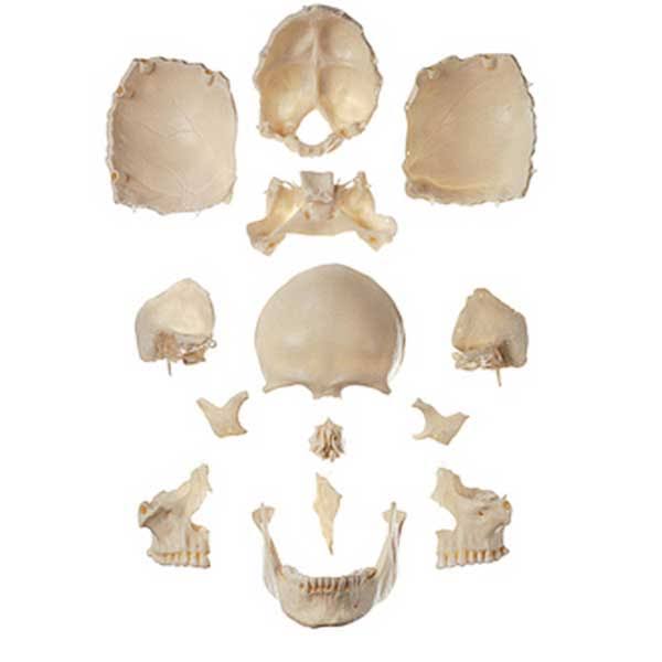 Disarticulated Human Skull N2773